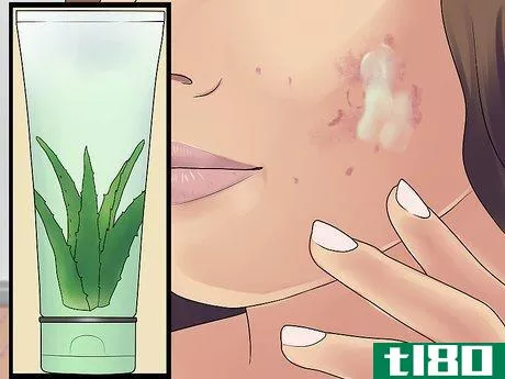 Image titled Get Rid of Cystic Acne Scars Step 3