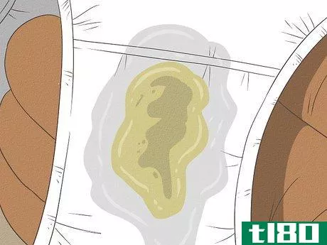 Image titled Get Rid of Vaginal Odor Fast Step 11