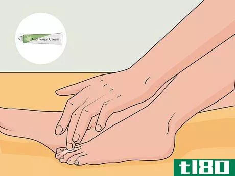 Image titled Get Rid of Foot Fungus at Home Step 01