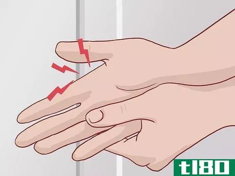 Image titled Know If Your Knuckle Is Broken Step 1
