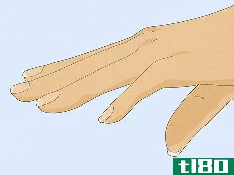 Image titled Get Rid of White Spots on Your Nails Step 7