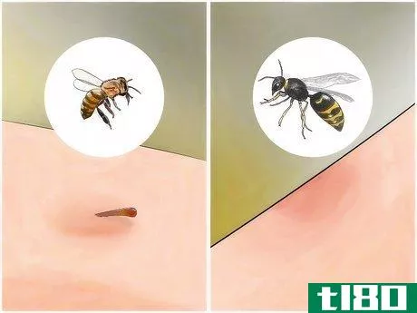 Image titled Identify Insect Bites Step 4
