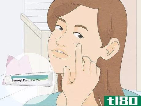 Image titled Get Rid of Pimples with Baking Soda Step 5