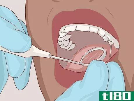 Image titled Know What to Expect when Getting a Tooth Implant Step 11