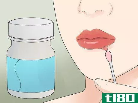 Image titled Get Rid of a Cold Sore Step 19