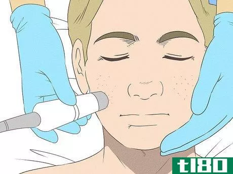 Image titled Get Rid of Spots on Your Skin Step 16