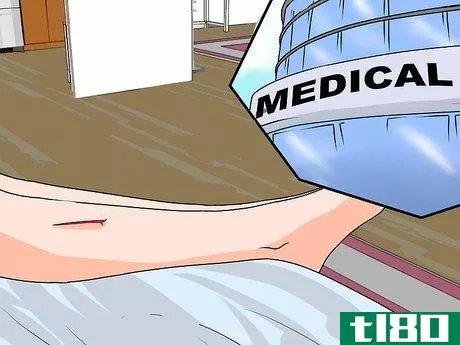 Image titled Heal a Hematoma Step 9