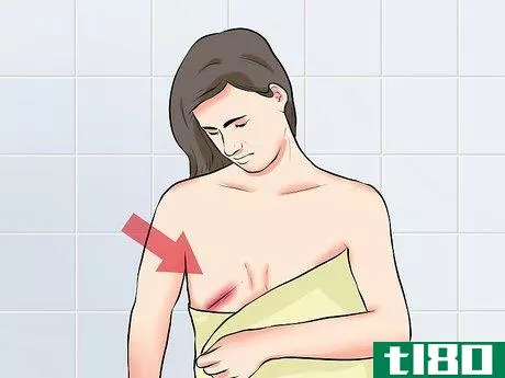 Image titled Know when to Call the Doctor After Mastectomy Surgery Step 14