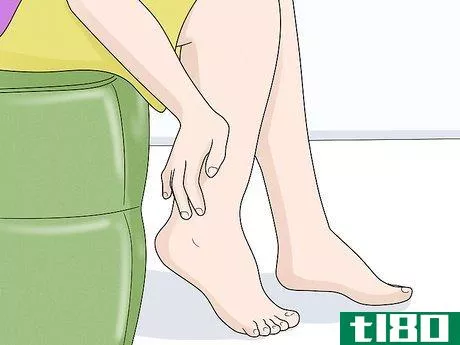 Image titled Identify Lymphedema Step 13