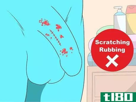 Image titled Get Rid of Genital Warts Step 12