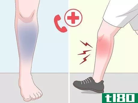 Image titled Get Rid of Leg Pain Step 16