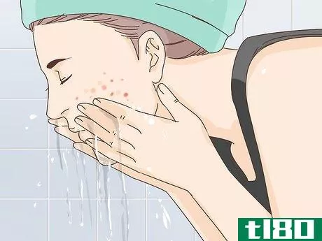 Image titled Get Rid of a Popped Pimple Overnight Step 4