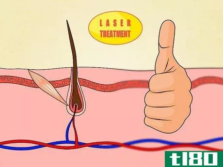 Image titled Get the Most Benefit from Laser Hair Removal Step 1