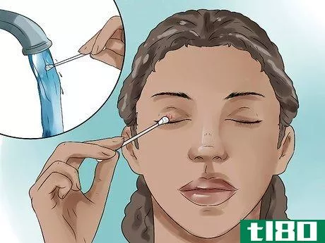 Image titled Get Rid of a Stye Step 1