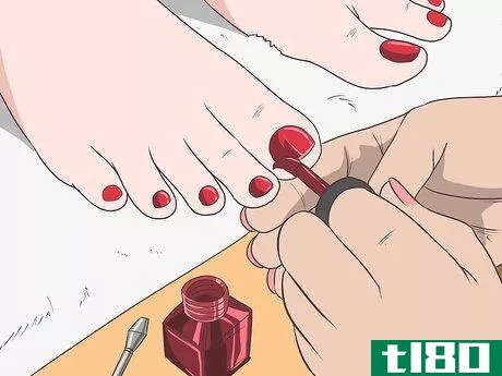 Image titled Get Rid of Psoriasis on Your Nails Step 15