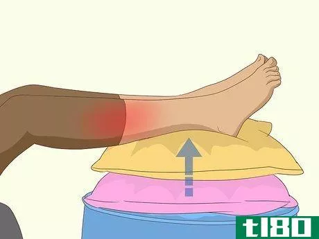 Image titled Get Rid of Leg Pain Step 2