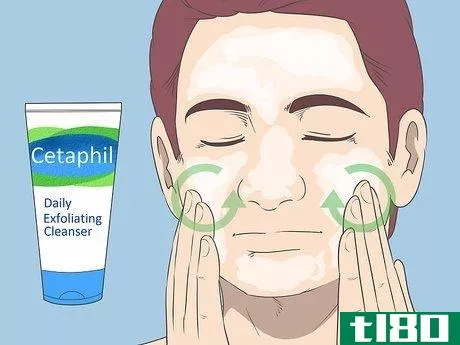 Image titled Get Rid of Acne if You Have Fair Skin Step 16