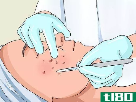 Image titled Get Rid of Large Pores and Blemishes Step 15