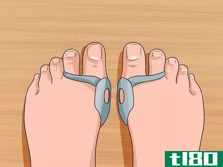 Image titled Get Rid of Bunions Step 5