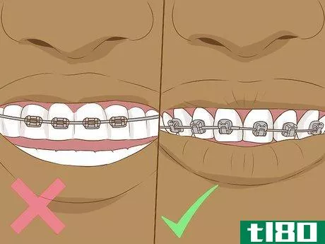 Image titled Make Fake Braces or a Fake Retainer Step 18