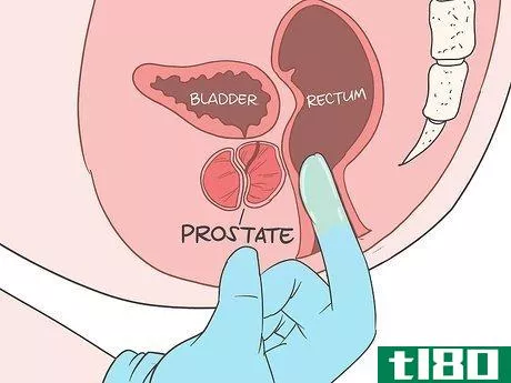 Image titled Locate Your Prostate Step 8