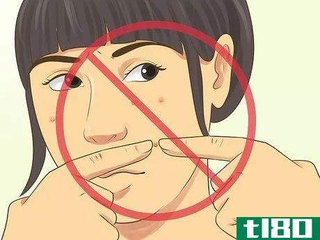 Image titled Not Let Acne Get You Down Step 4