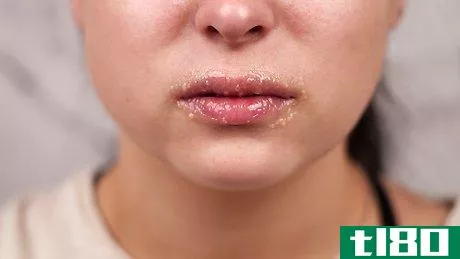 Image titled Make Honey Lip Scrub Step 5