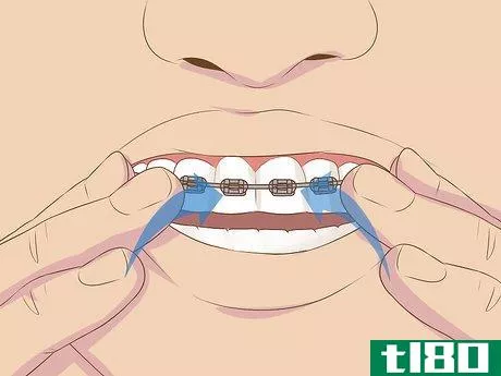 Image titled Make Fake Braces or a Fake Retainer Step 10
