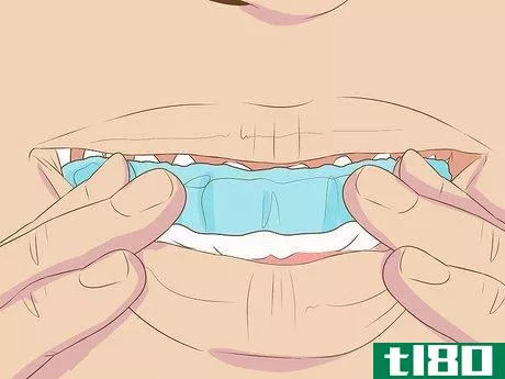 Image titled Make Fake Braces or a Fake Retainer Step 15