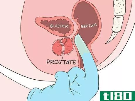 Image titled Locate Your Prostate Step 9