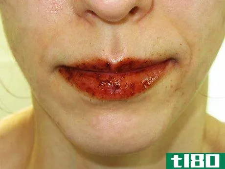Image titled Make Your Own Lip Plumper at Home Step 16