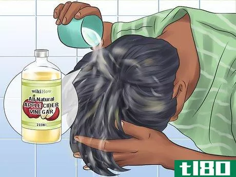 Image titled Get Rid of Lice Step 6