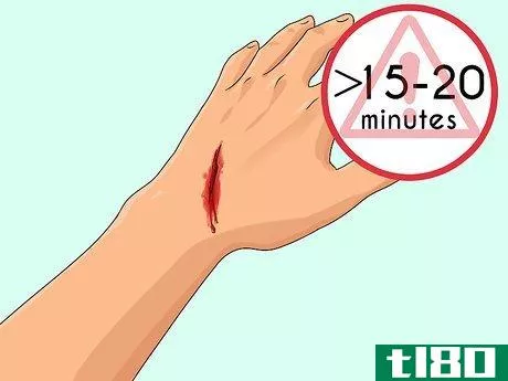Image titled Make Blood Coagulate Faster Step 4
