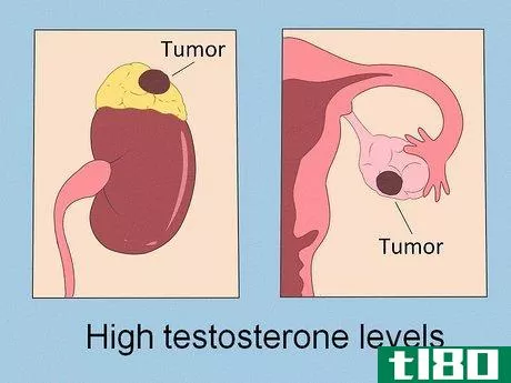 Image titled Lower Testosterone Levels Step 8