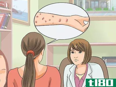 Image titled Identify an HIV Rash Step 7