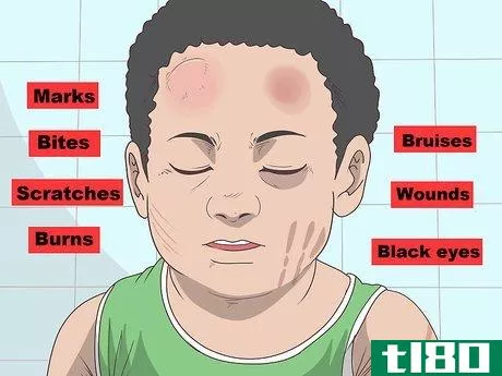 Image titled Recognize Signs of Abuse in a Toddler or Baby Step 10