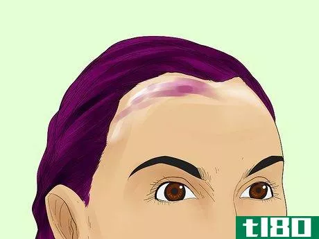Image titled Remove Hair Dye from Your Scalp Step 12