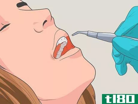 Image titled Overcome Your Fear of the Dentist Step 4