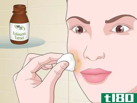 Image titled Prevent Acne Naturally Step 13