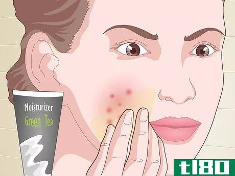 Image titled Prevent Acne Naturally Step 12