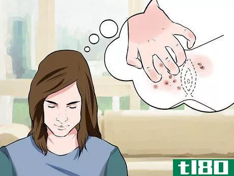 Image titled Recognize Genital Warts Step 2