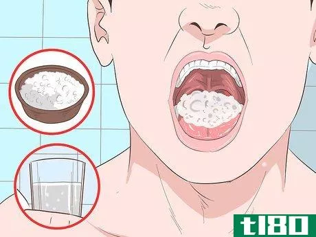 Image titled Remove Tonsil Stones (Tonsilloliths) Step 13