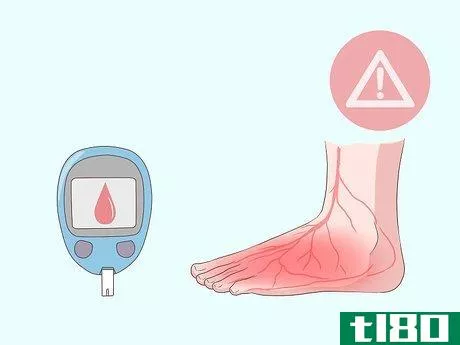 Image titled Relieve Ingrown Toe Nail Pain Step 4