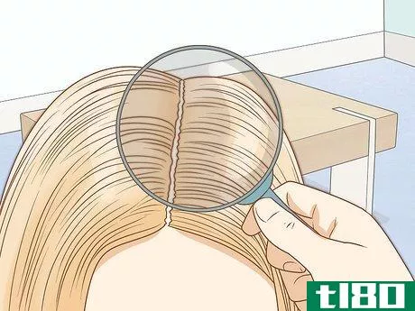 Image titled Recognize Head Lice Step 3