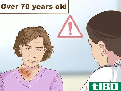Image titled Recognize Shingles Symptoms (Herpes Zoster Symptoms) Step 13