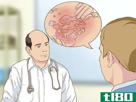 Image titled Recognize Shingles Symptoms (Herpes Zoster Symptoms) Step 11