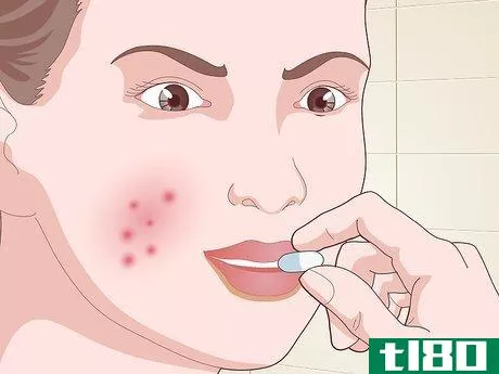 Image titled Prevent Acne Naturally Step 14