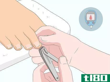 Image titled Relieve Ingrown Toe Nail Pain Step 31