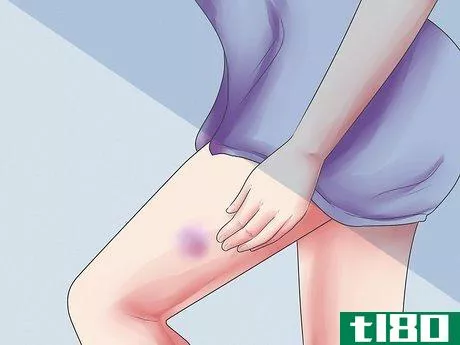 Image titled Recognize Symptoms of a Postpartum Hemorrhage Step 4