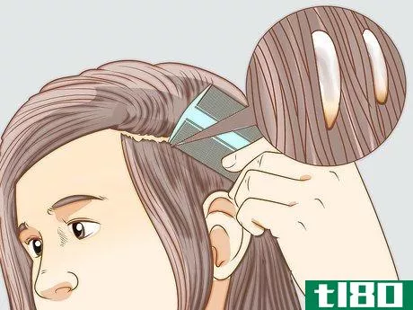 Image titled Recognize Head Lice Step 2